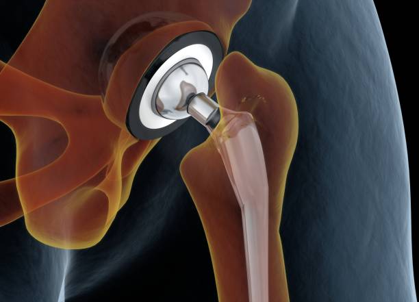 the hip socket (acetabulum)