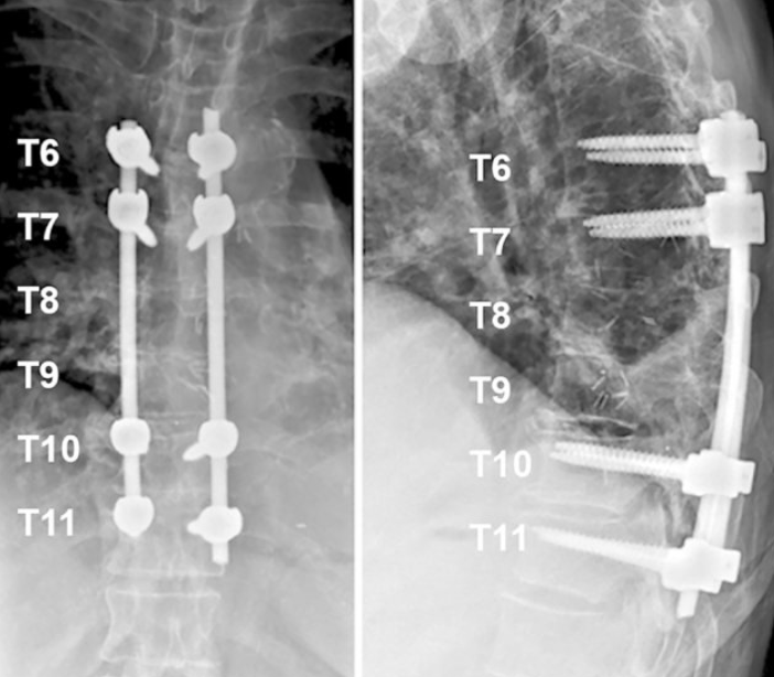 Postoperative X-rays